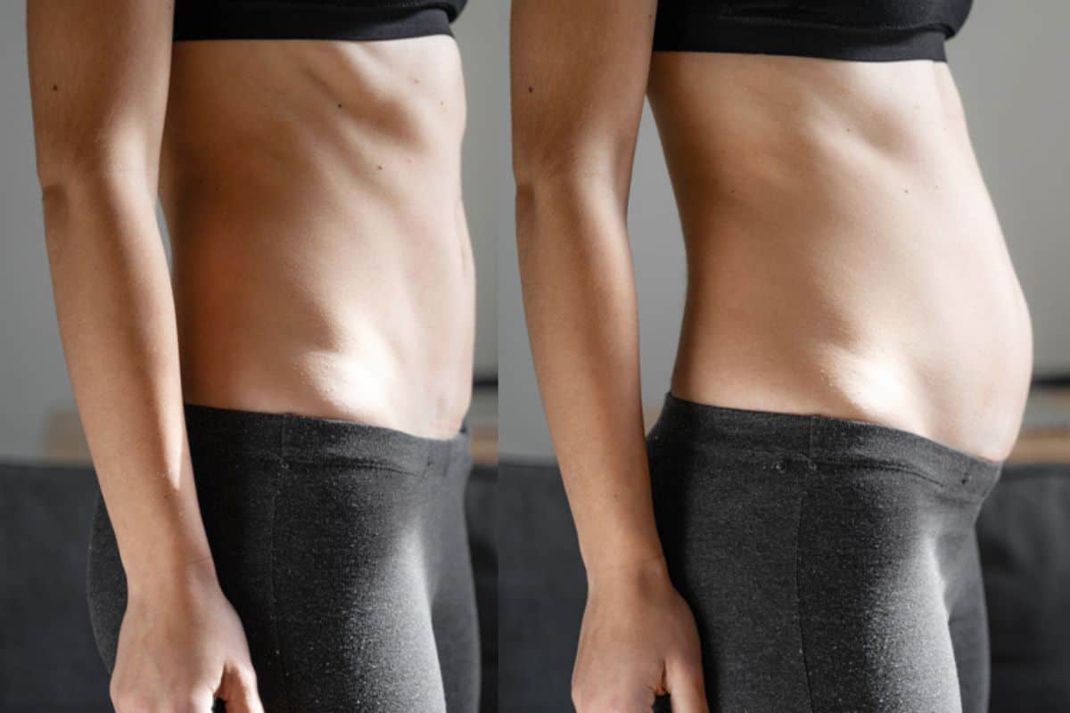 How long does diastasis recti take to improve Earl's Court?