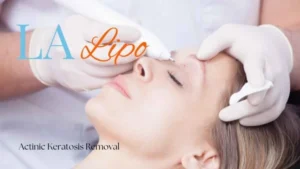 Woman receiving Actinic Keratosis Removal Treatment Earl's Court