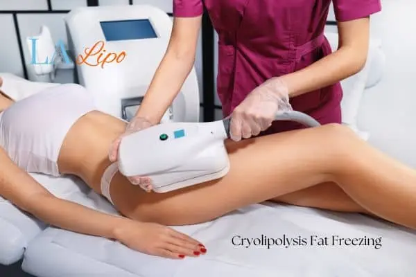 Woman receiving coolsculpting Earl's Court treatment on her thighs