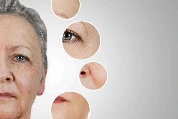HIFU Facelift Earl's Court from LA LIPO