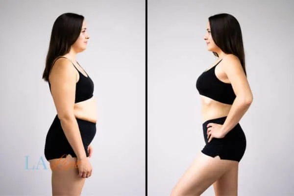 link between body image and mental health Earl's Court