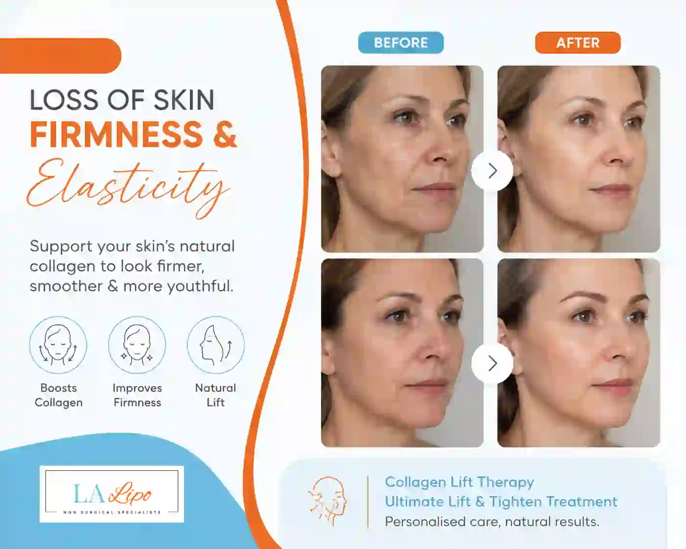 Sign #7: Loss of Skin Firmness and Elasticity Earl's Court
